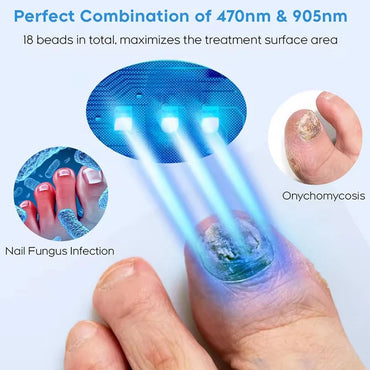 Nail Fungus Laser Device Cure Onychomycosis Toenail Fingernail