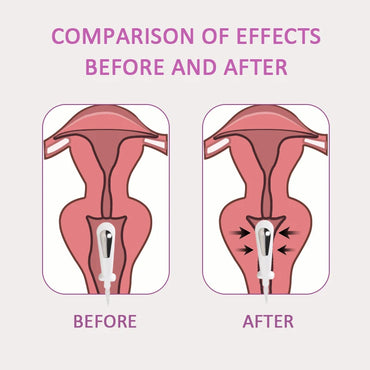 EMS Pelvic floor Muscle Stimulator Trainer Kegel