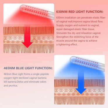 Red Light Therapy Tightening Vaginitis Gynecological Diseases
