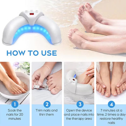 Nail Fungus Laser Device Cure Onychomycosis Toenail Fingernail