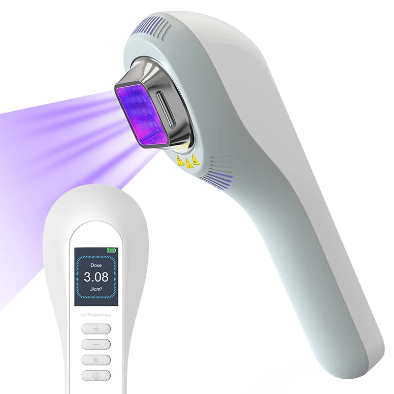 Light UVB Therapy for Vitiligo, Psoriasis