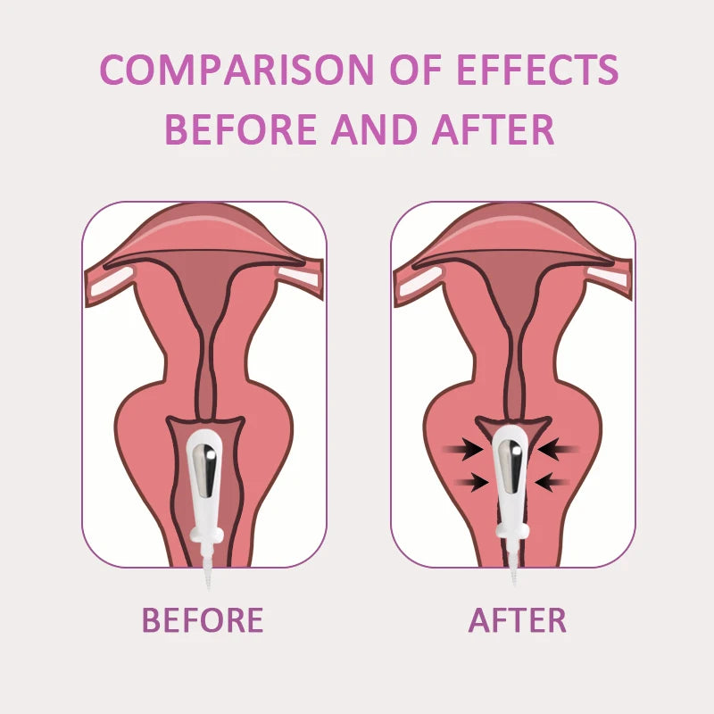 EMS Pelvic floor Muscle Stimulator Trainer Kegel