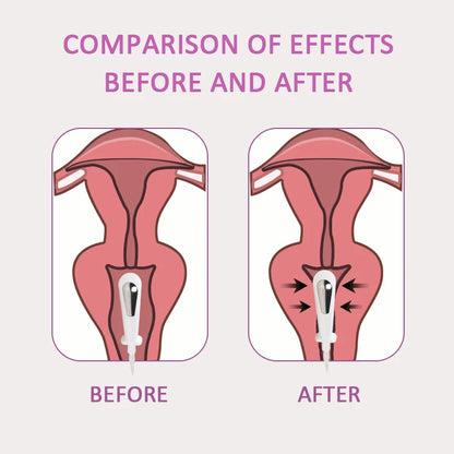EMS Pelvic floor Muscle Stimulator Trainer Kegel