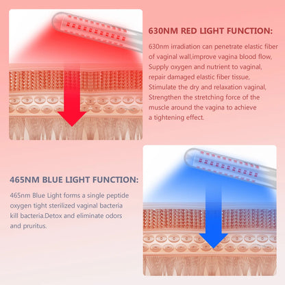 Red Light Therapy  Tightening Vaginitis Gynecological Diseases