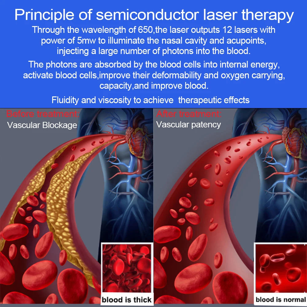 Laser Wrist Watch Hypertension  Diabetes  Rhinitis Sinusitis