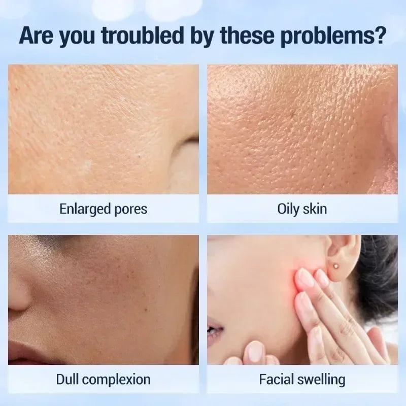 Red Blue light  Radio Frequency  Lift Firming Lines Age Skin Rejuvenation