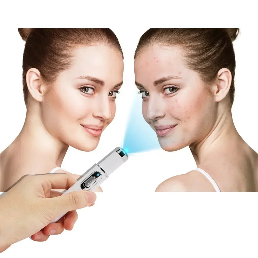 Laser  Pen Therapy for Scars & Skin Spots